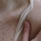 @almaeuridice